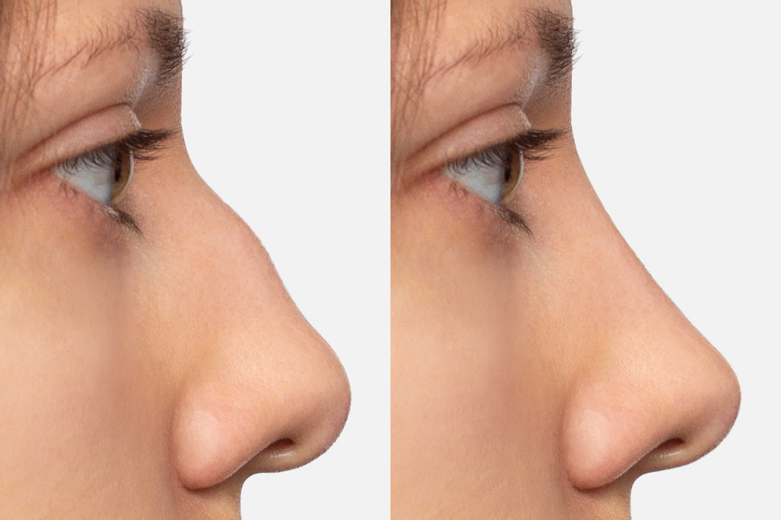 istock 2161467575 optimized