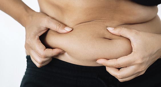 J Plasma fat removal ottawa