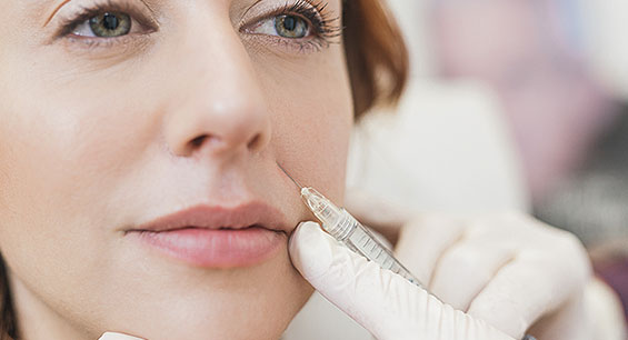 fillers ottawa before and after pics
