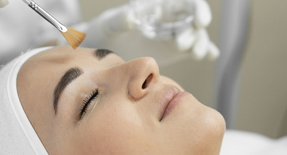 ottawa chemical peel