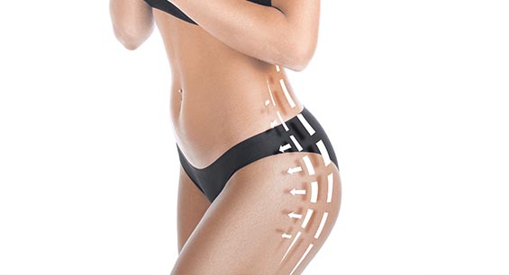 wide awake liposuction before after photos