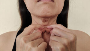 The flabbiness wrinkles adipose sagging and dull skin under the neck.
